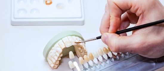 Chirurgiens-dentistes : pas d'accès partiel pour les prothésistes